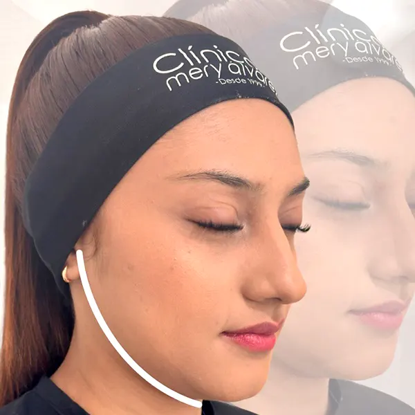 Img-ClinicaMeryAlvarez-Tratamientos-Endolift_láser