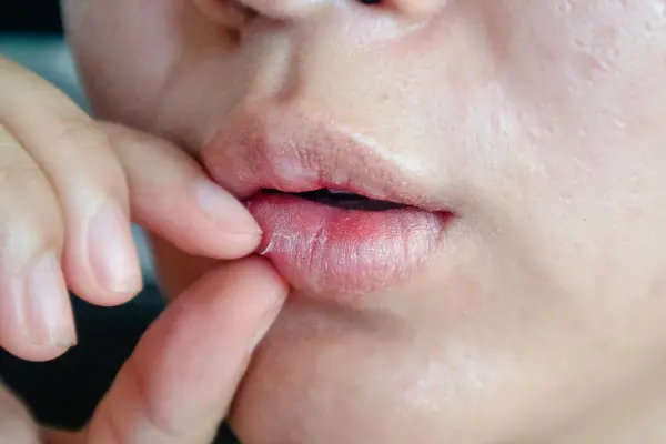 Los labios resecos pueden incomodarte y afectar tu apariencia. Si buscas saber cómo quitar los labios resecos rápido, este blog te brinda soluciones que combinan cuidado y estética para revitalizar...